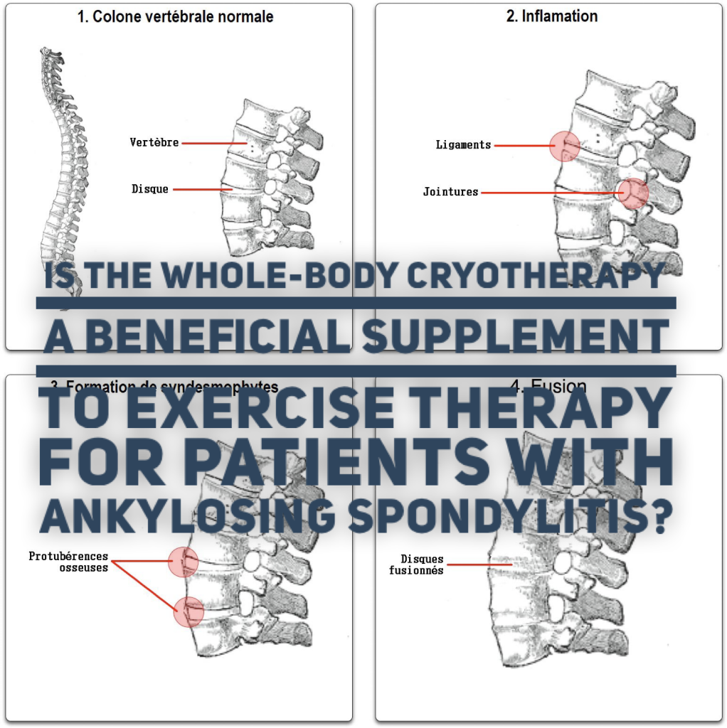 Is the whole-body cryotherapy a beneficial supplement to exercise therapy for patients with ankylosing spondylitis?